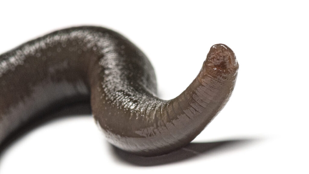 Man accidentally gets leech up his nose. It took 20 days to figure it out.