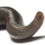 Man accidentally gets leech up his nose. It took 20 days to figure it out.