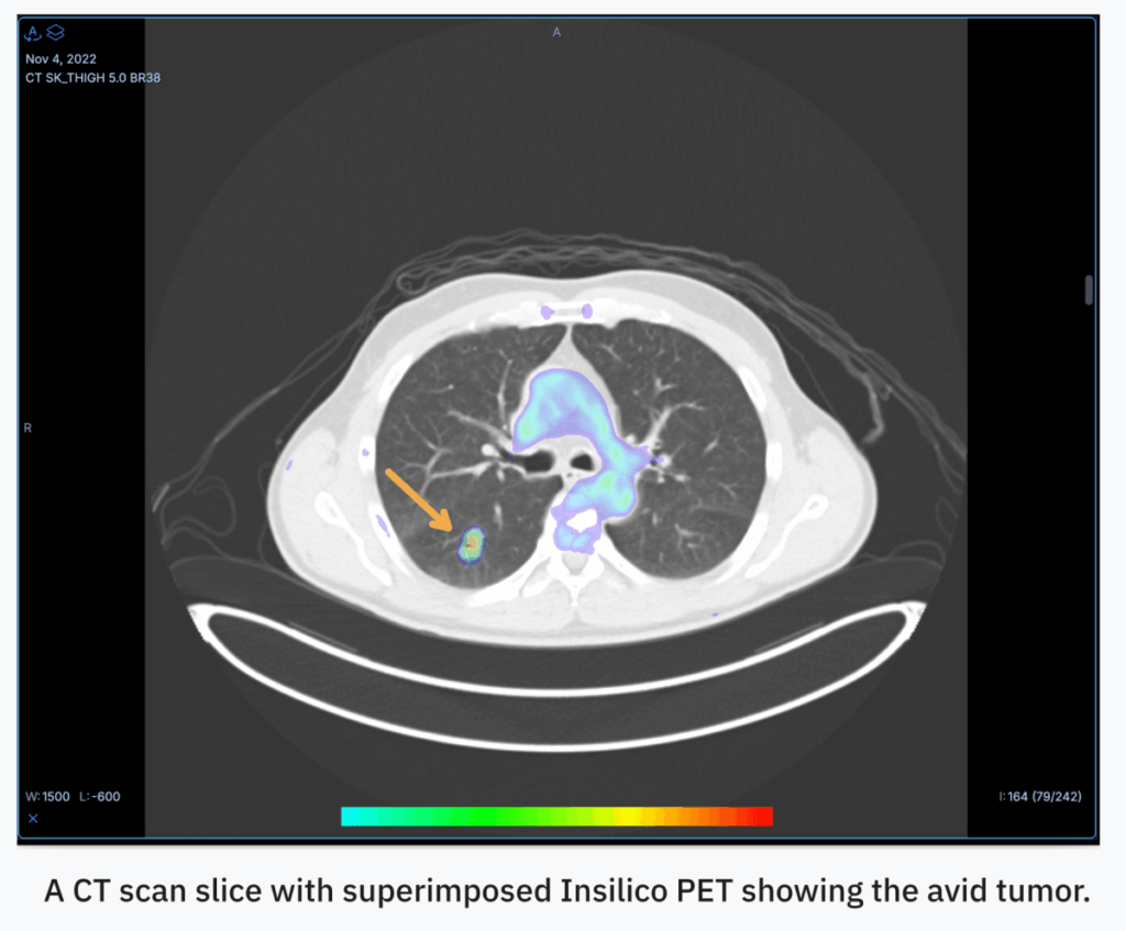 Oxford spinout RADiCAIT uses AI to make diagnostic imaging more affordable and accessible — catch it at TechCrunch Disrupt 2025
