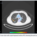 Oxford spinout RADiCAIT uses AI to make diagnostic imaging more affordable and accessible — catch it at TechCrunch Disrupt 2025