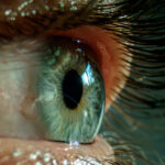 Bad sleep made woman’s eyelids so floppy they flipped inside out, got stuck