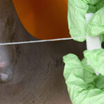 Guinea worm on track to be 2nd eradicated human disease; only 10 cases in 2025