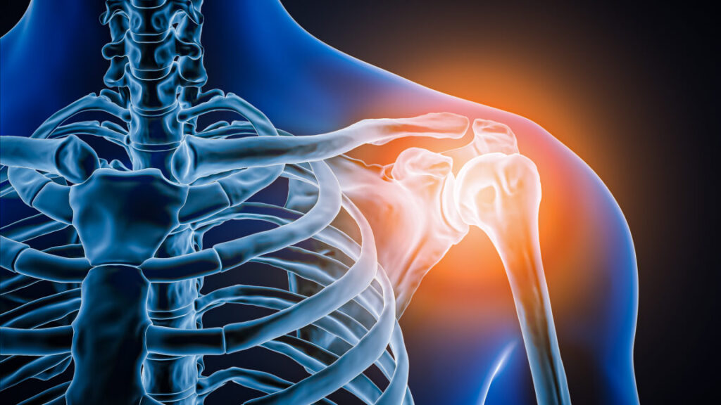 Doctors took a look at man’s painful shoulder—they found the joint was missing