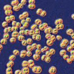 College lab class ends with 32 people on antibiotics for deadly germ exposure